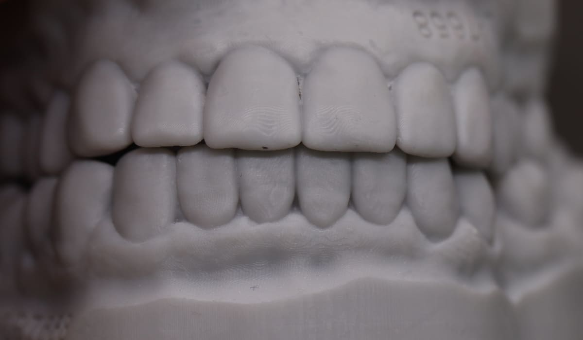 Vassoi Per Stampa Dentale Set Di 6 In Materiale Solido - Strumenti Per Protesi Dentali, Nuovo, Marca Slake Impex Plastificatrice A3