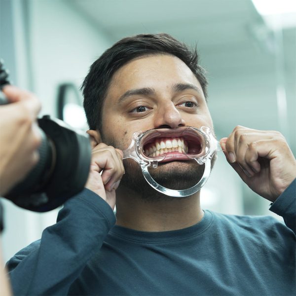 Fotografia Odontoiatrica - immagine 5