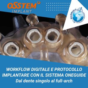 Workflow digitale e protocollo implantare con il sistema OneGuide - Dal dente singolo al full arch