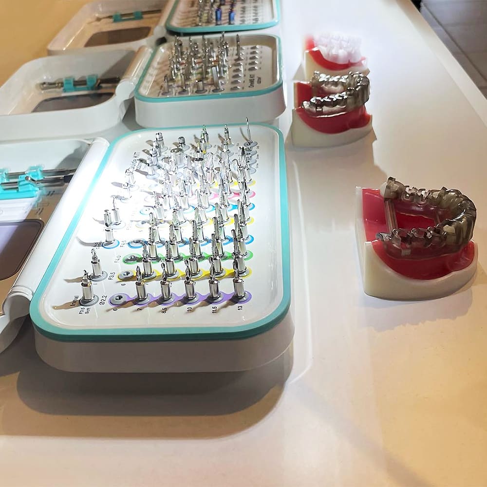 Workflow digitale e protocollo implantare con il sistema OneGuide - Dal dente singolo al full arch - immagine 3 Workflow digitale e protocollo implantare con il sistema OneGuide - Dal dente singolo al full arch - immagine 3